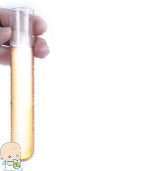 液氮存储